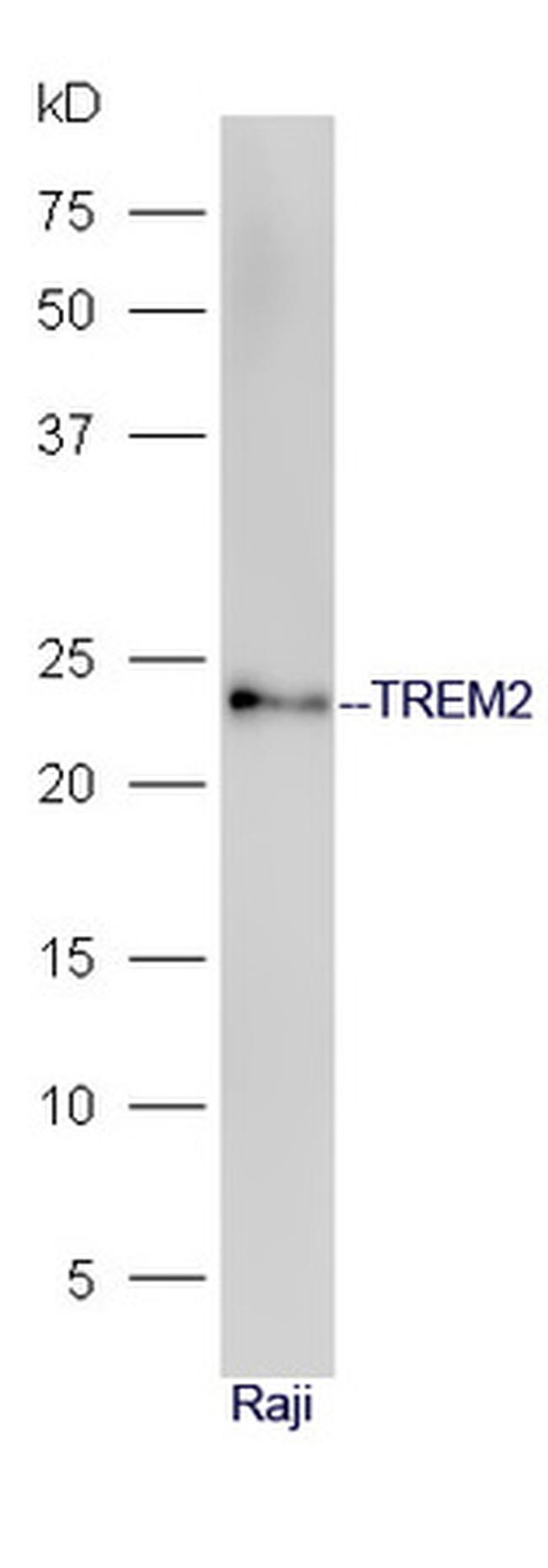 TREM2 Antibody in Western Blot (WB)