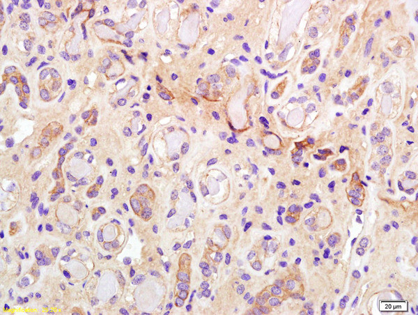 Phospho-IRS-1 (Ser307) Antibody in Immunohistochemistry (Paraffin) (IHC (P))