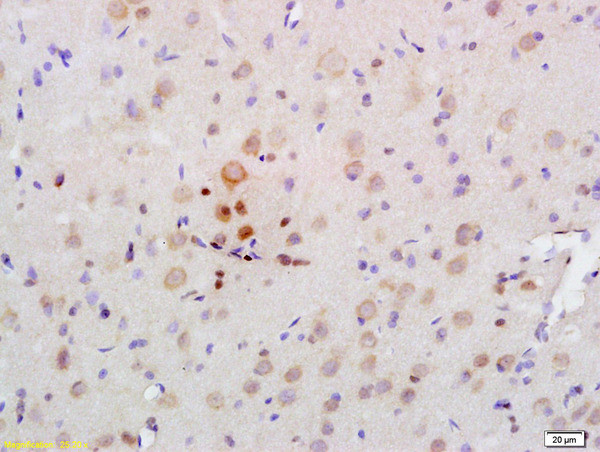 AMPK alpha 2 Antibody in Immunohistochemistry (Paraffin) (IHC (P))