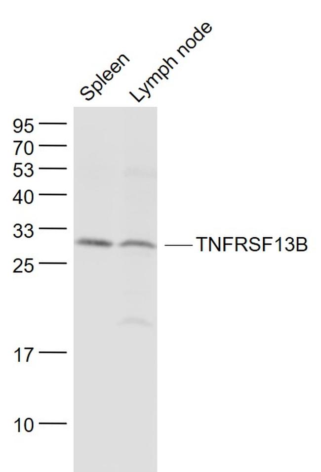 TNFRSF13B Antibody in Western Blot (WB)