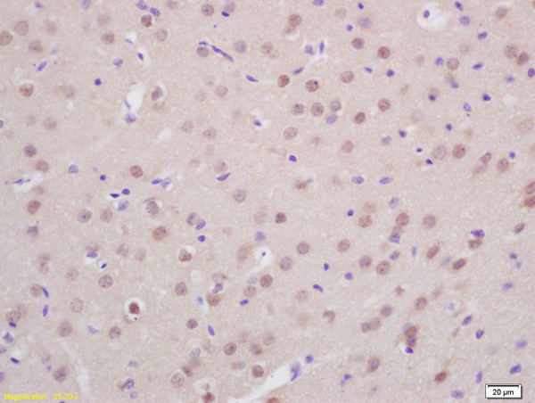 Prox1 Antibody in Immunohistochemistry (Paraffin) (IHC (P))