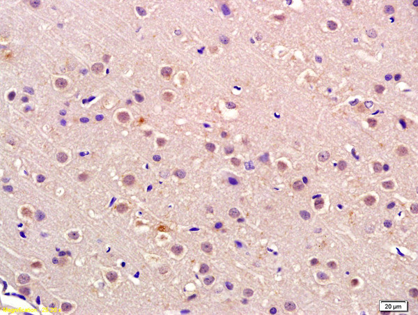 P105 RB Antibody in Immunohistochemistry (Paraffin) (IHC (P))