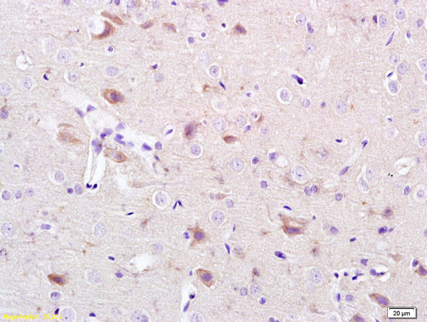 CACNA1G Antibody in Immunohistochemistry (Paraffin) (IHC (P))