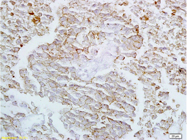 Claudin 4 Antibody in Immunohistochemistry (Paraffin) (IHC (P))