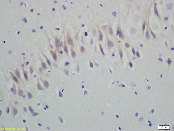 RGS5 Antibody in Immunohistochemistry (Paraffin) (IHC (P))