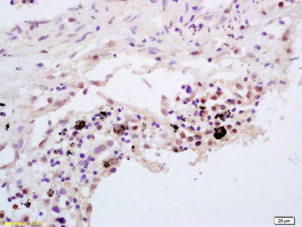 TNFAIP3 Antibody in Immunohistochemistry (Paraffin) (IHC (P))