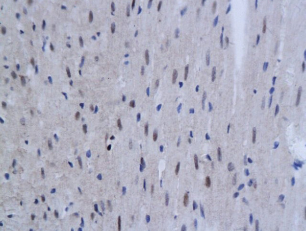 TNFAIP3 Antibody in Immunohistochemistry (Paraffin) (IHC (P))