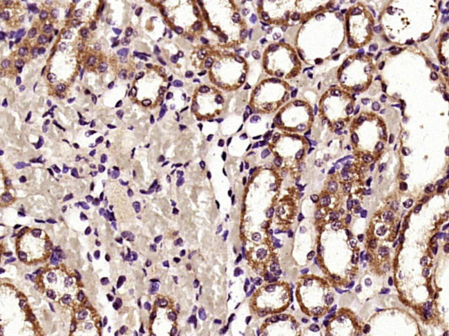 HDAC6 Antibody in Immunohistochemistry (Paraffin) (IHC (P))