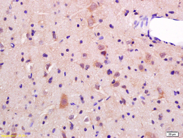 JNK1/2 Antibody in Immunohistochemistry (Paraffin) (IHC (P))