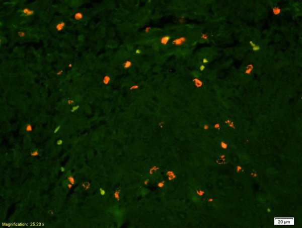 Lyn Antibody in Immunohistochemistry (Paraffin) (IHC (P))