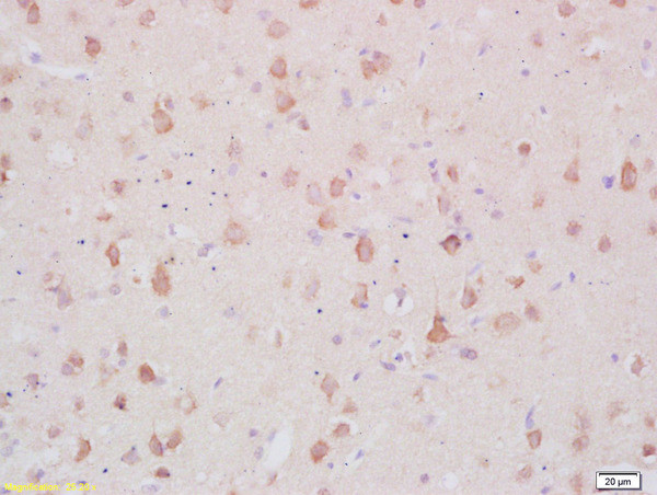 MARCKS Antibody in Immunohistochemistry (Paraffin) (IHC (P))