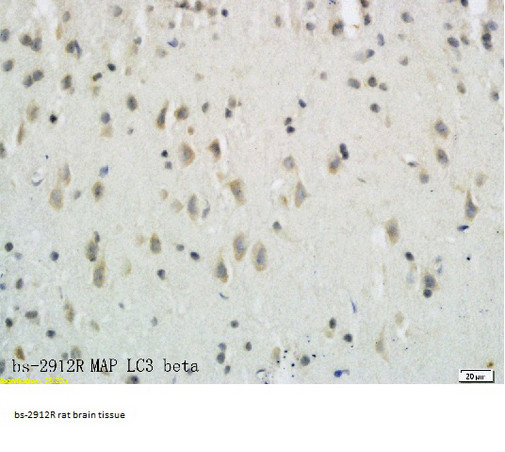 MAP1A/MAP1B LC3 A/B Antibody in Immunohistochemistry (Paraffin) (IHC (P))