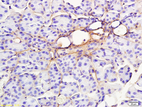 RAP1GAP Antibody in Immunohistochemistry (Paraffin) (IHC (P))