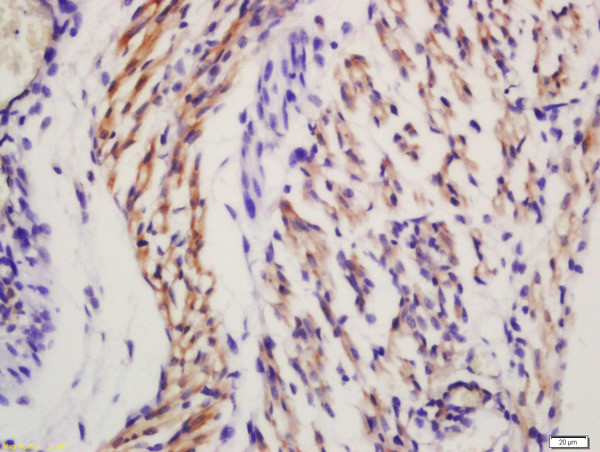 Frizzled 5/8 Antibody in Immunohistochemistry (Paraffin) (IHC (P))