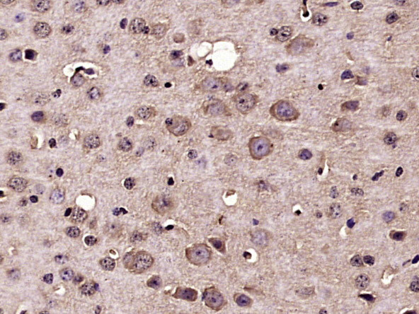 Nucleoporin p62 Antibody in Immunohistochemistry (Paraffin) (IHC (P))