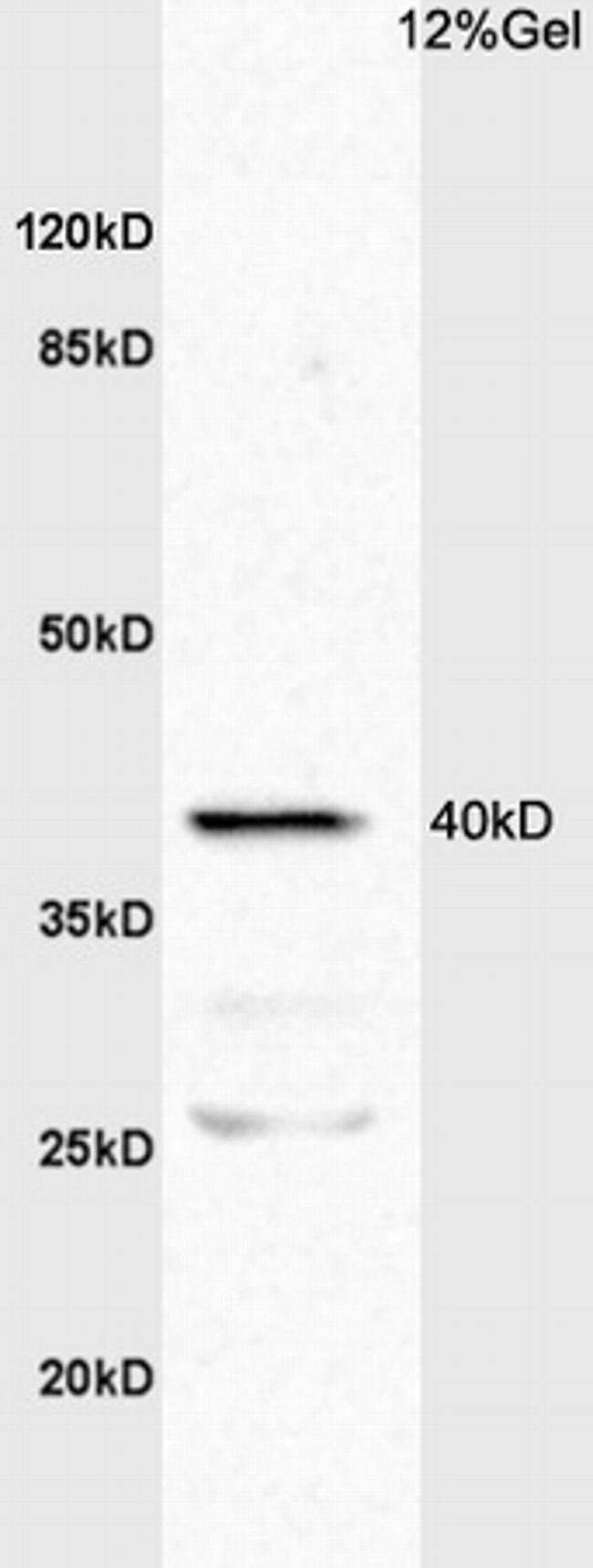 TNFR1 Antibody in Western Blot (WB)