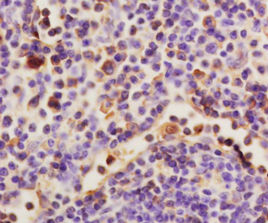 HAS1 Antibody in Immunohistochemistry (Paraffin) (IHC (P))