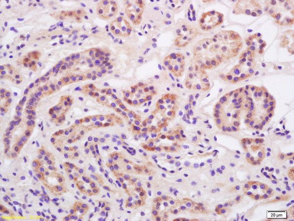 Alpha-ENaC Antibody in Immunohistochemistry (Paraffin) (IHC (P))