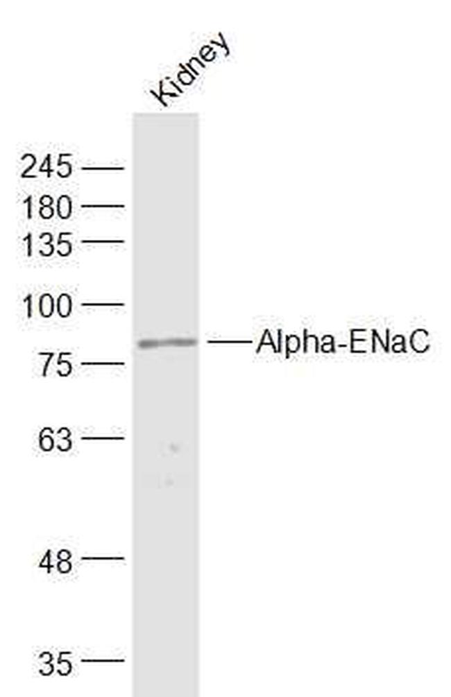 Alpha-ENaC Antibody in Western Blot (WB)