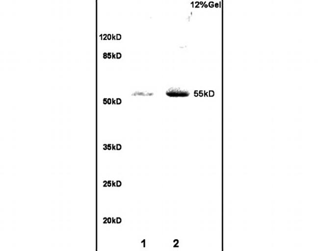 RBPJK Antibody in Western Blot (WB)