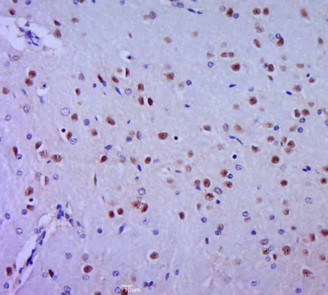 HES1 Antibody in Immunohistochemistry (Paraffin) (IHC (P))