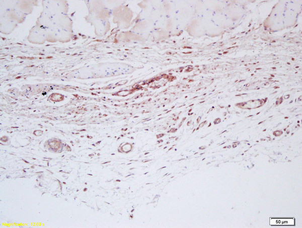 Factor 8 Antibody in Immunohistochemistry (Paraffin) (IHC (P))