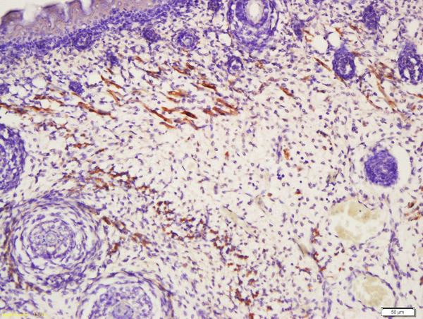 TAGL2 Antibody in Immunohistochemistry (Paraffin) (IHC (P))