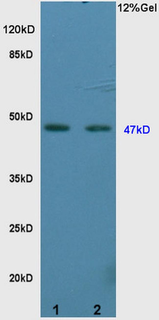 Vitamin D Receptor/VDR Antibody in Western Blot (WB)