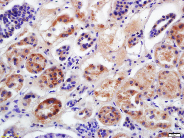 CYP2D6 Antibody in Immunohistochemistry (Paraffin) (IHC (P))