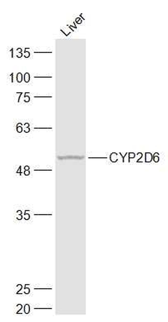 CYP2D6 Antibody in Western Blot (WB)