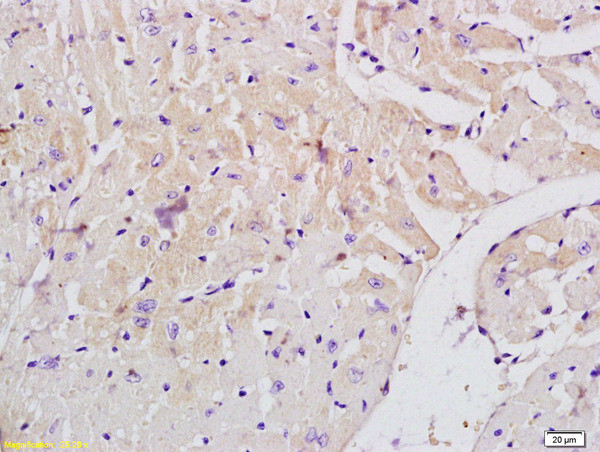 MLK3 Antibody in Immunohistochemistry (Paraffin) (IHC (P))