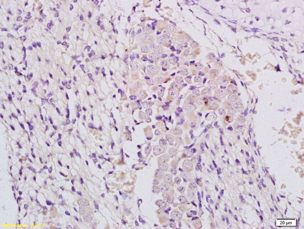 MLK3 Antibody in Immunohistochemistry (Paraffin) (IHC (P))