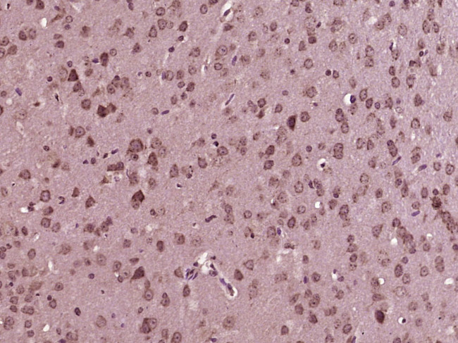 MLK3 Antibody in Immunohistochemistry (Paraffin) (IHC (P))