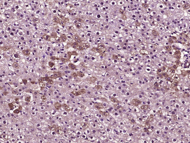 MLK3 Antibody in Immunohistochemistry (Paraffin) (IHC (P))