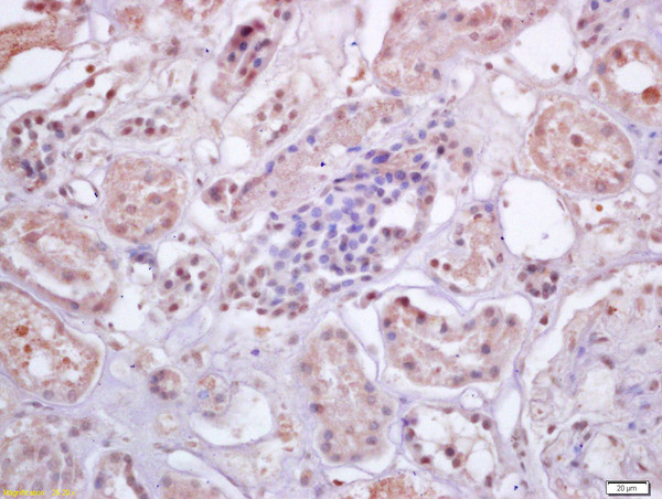 IRF3 Antibody in Immunohistochemistry (Paraffin) (IHC (P))