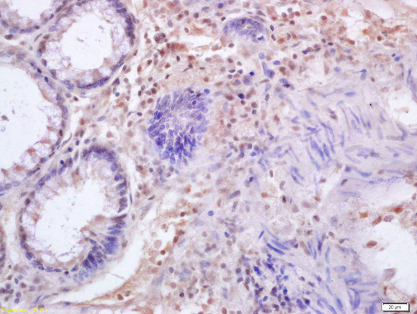 IRF3 Antibody in Immunohistochemistry (Paraffin) (IHC (P))