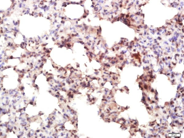 IRF7 Antibody in Immunohistochemistry (Paraffin) (IHC (P))