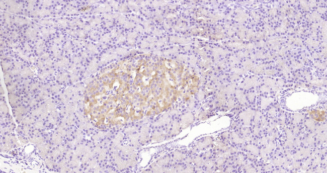 Phospho-Bax (Ser184) Antibody in Immunohistochemistry (Paraffin) (IHC (P))