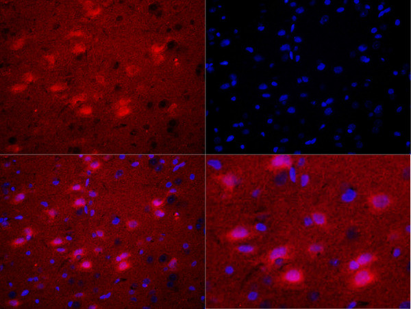 Phospho-Bax (Ser184) Antibody in Immunohistochemistry (Paraffin) (IHC (P))