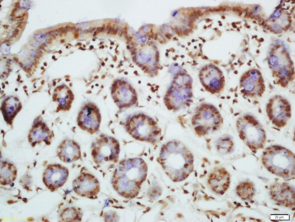 Phospho-Bim (Ser87) Antibody in Immunohistochemistry (Paraffin) (IHC (P))