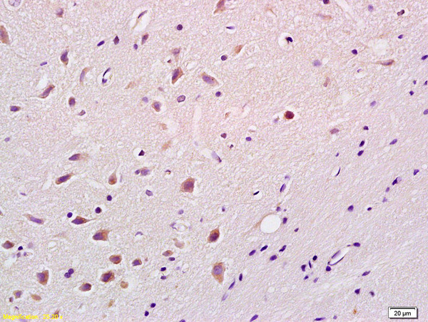 Phospho-Bim (Ser87) Antibody in Immunohistochemistry (Paraffin) (IHC (P))