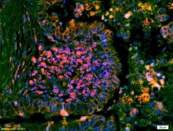 Phospho-ERK1/2 (Thr202, Tyr204) Antibody in Immunohistochemistry (Paraffin) (IHC (P))