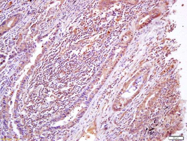 Phospho-AMPK beta 1 (Ser182) Antibody in Immunohistochemistry (Paraffin) (IHC (P))