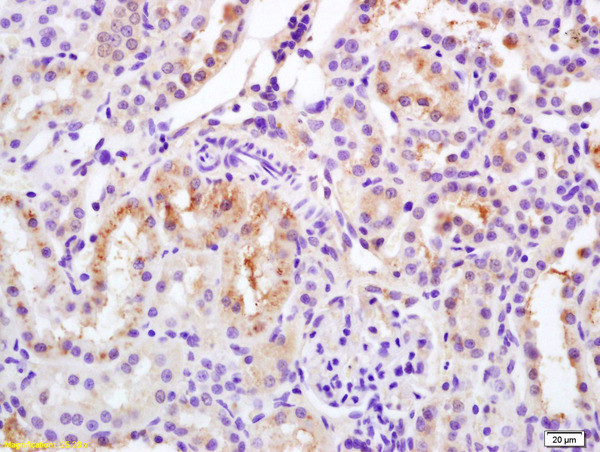 Phospho-Bcl-2 (Ser70) Antibody in Immunohistochemistry (Paraffin) (IHC (P))