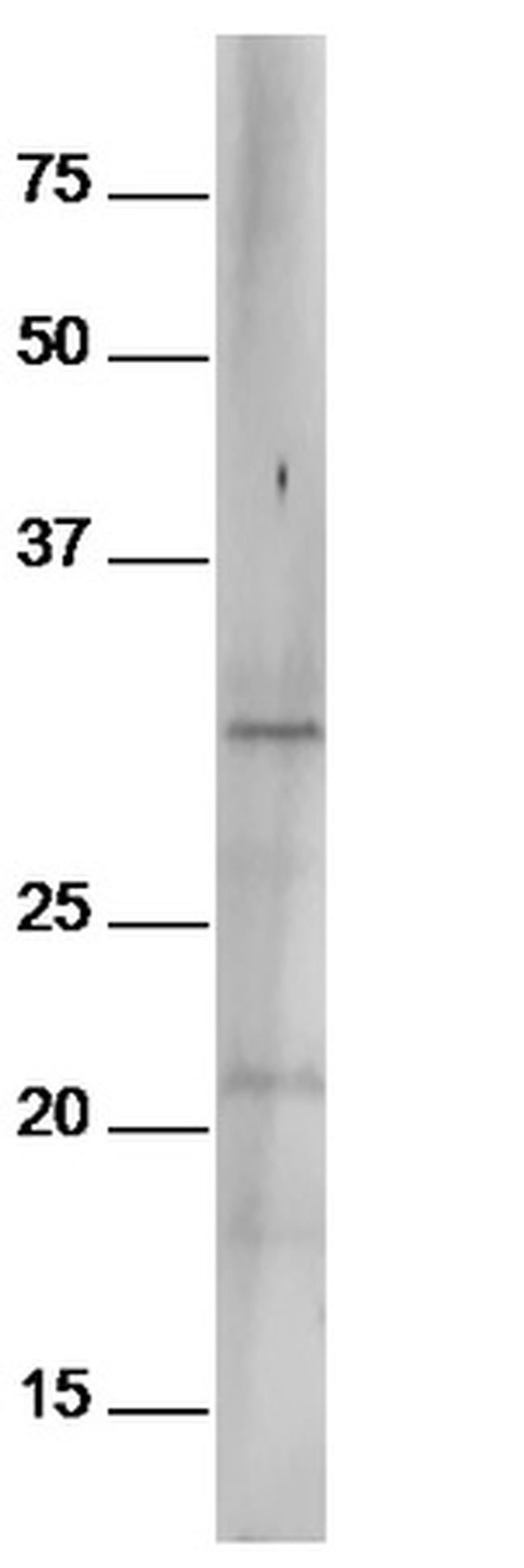 Phospho-Bcl-2 (Ser70) Antibody in Western Blot (WB)