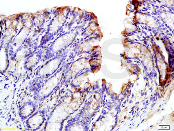 Phospho-GCN2 (Thr667) Antibody in Immunohistochemistry (Paraffin) (IHC (P))