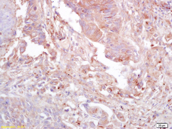 Phospho-FAK (Tyr397) Antibody in Immunohistochemistry (Paraffin) (IHC (P))