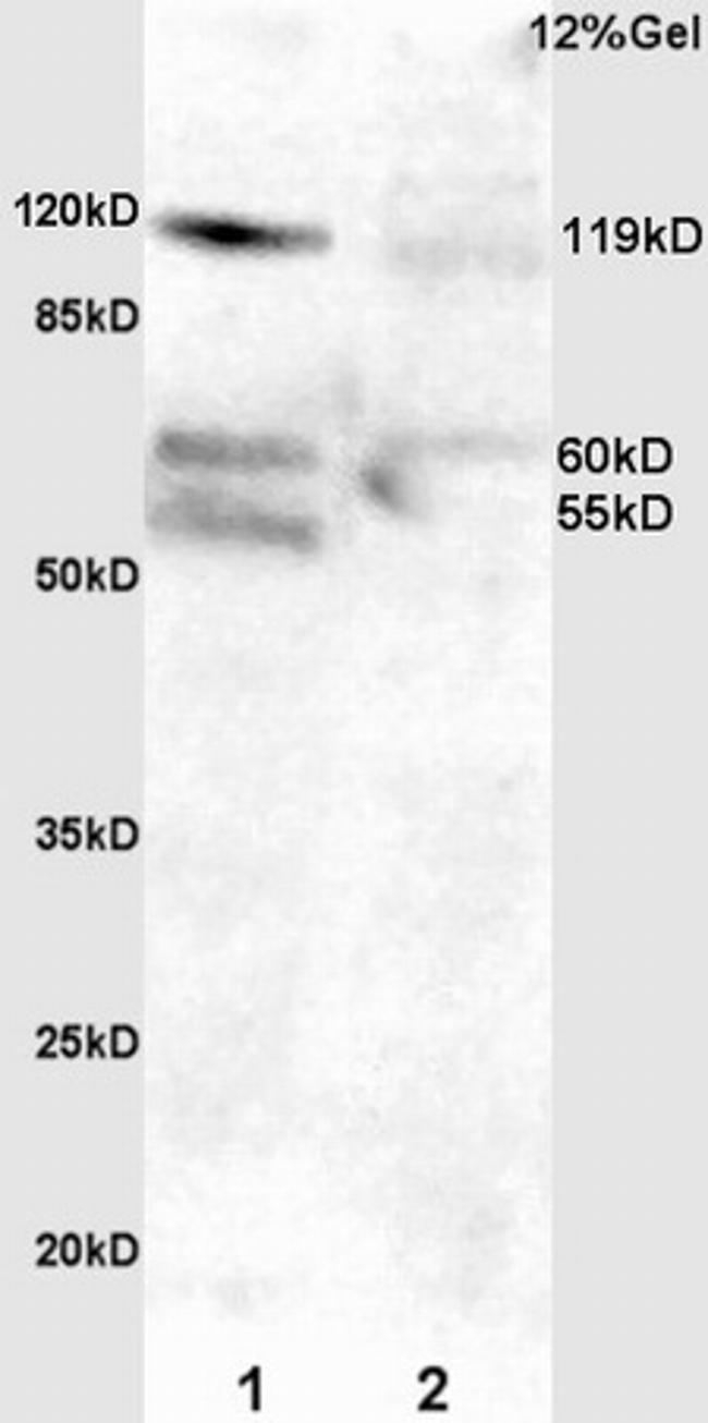 Phospho-FAK (Tyr397) Antibody in Western Blot (WB)