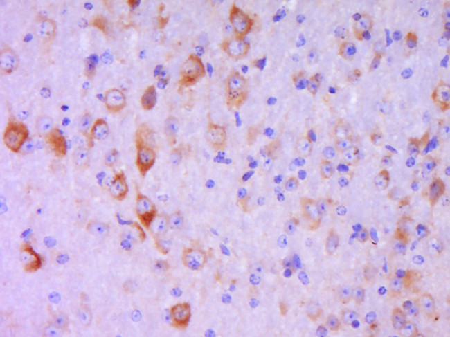 Phospho-FAK (Tyr407) Antibody in Immunohistochemistry (Paraffin) (IHC (P))