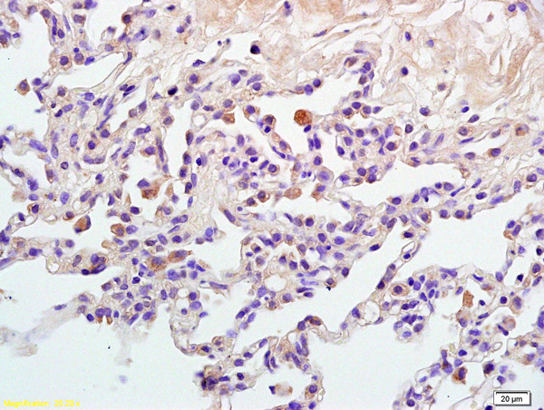 Phospho-GAB2 (Tyr452) Antibody in Immunohistochemistry (Paraffin) (IHC (P))